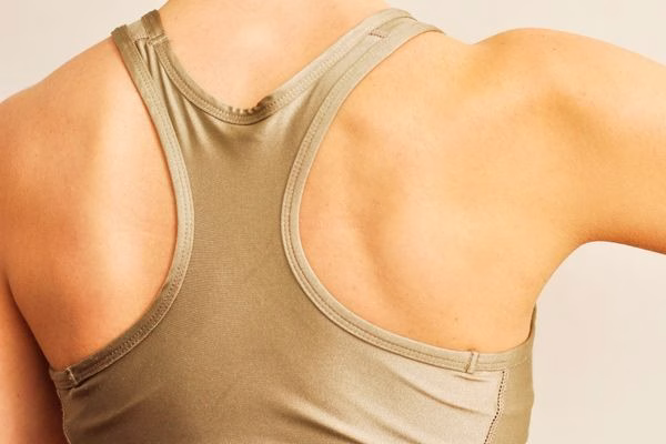 Tendinitis calcificante